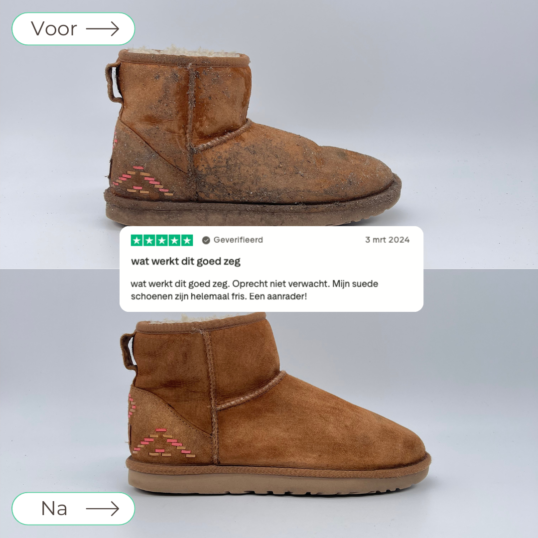 UGGs Bundel